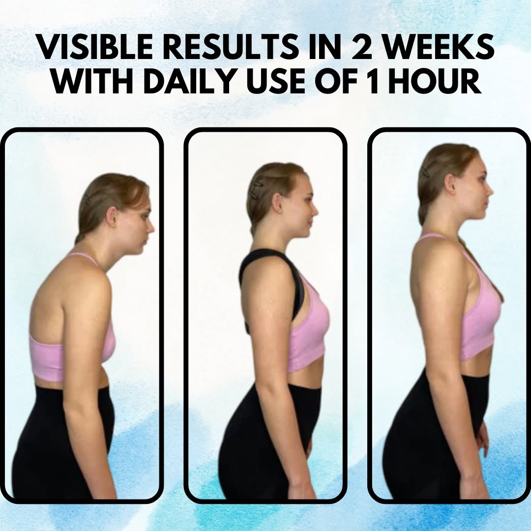 Posture Corrector